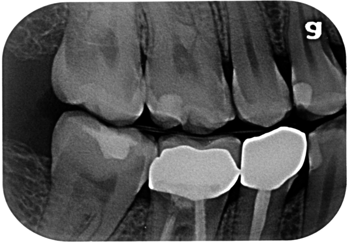 Advanced & Restorative Dentistry